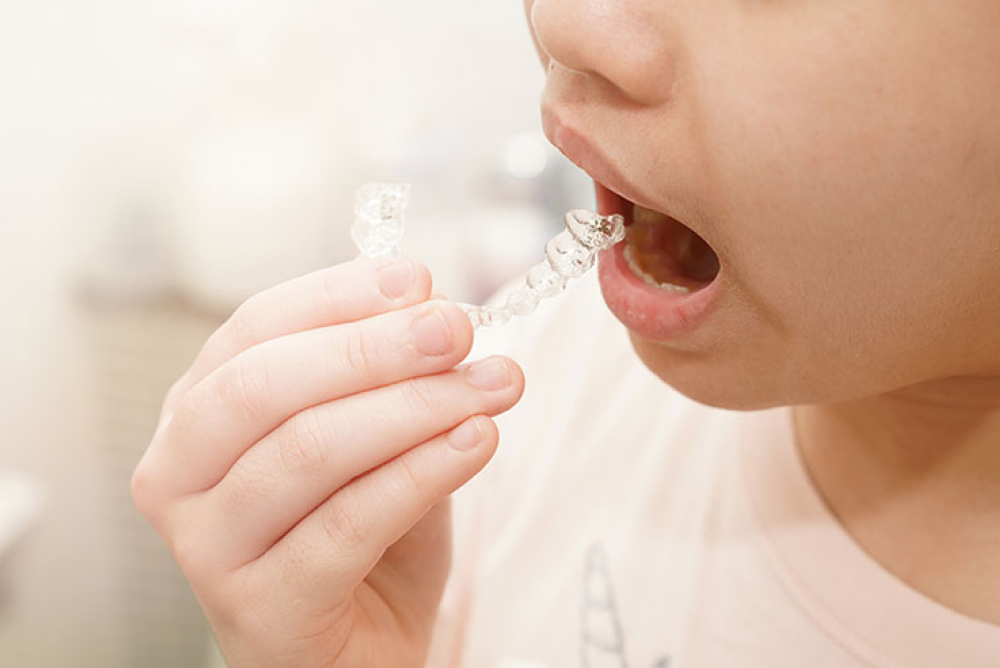 子どもの矯正治療とは？