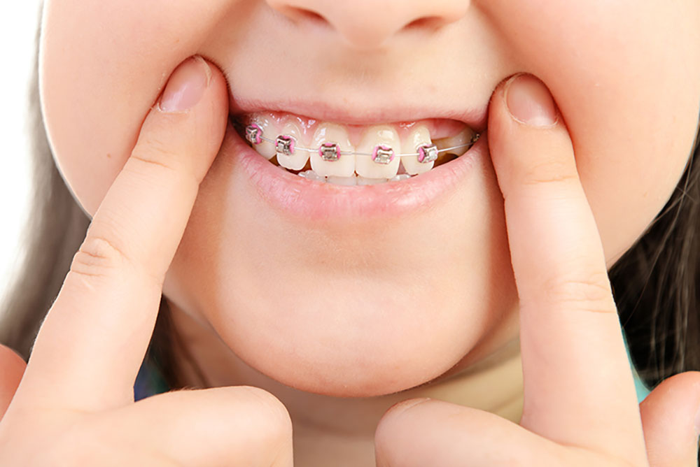 むし歯のリスクが高くなることがある