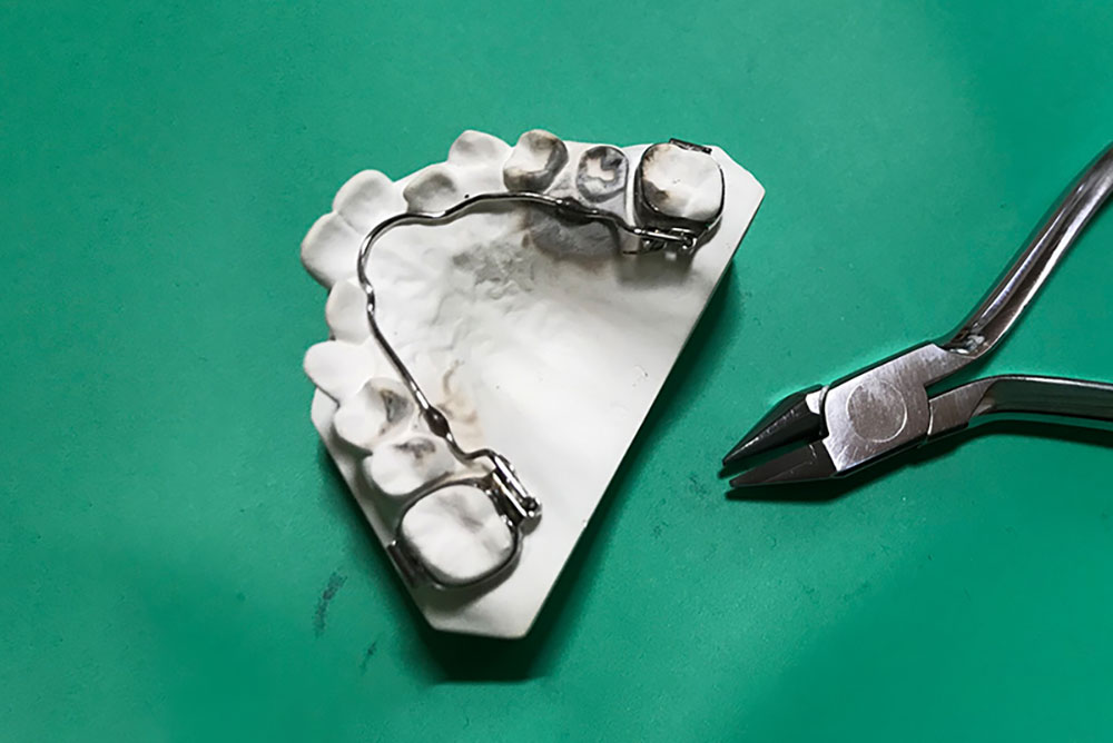 リンガルアーチ