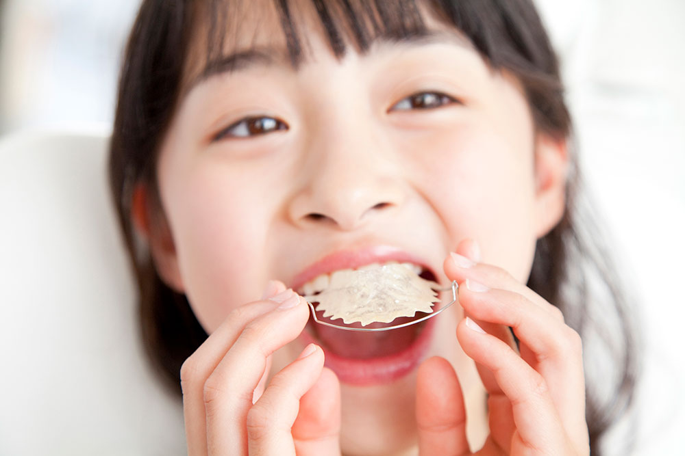 矯正治療スタート