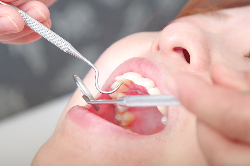 予防・クリーニングとは？