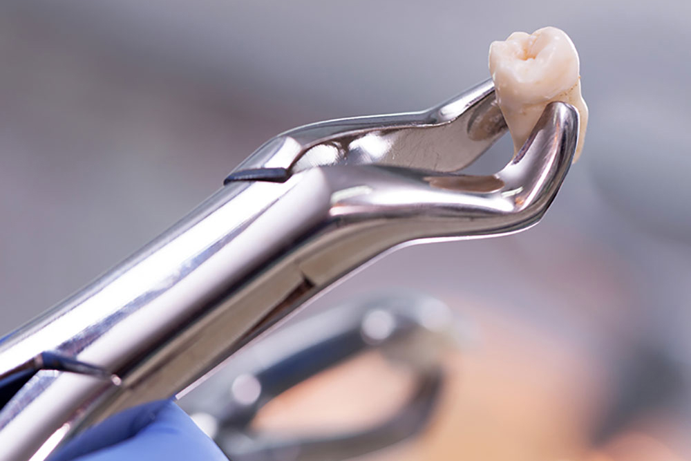 歯科口腔外科とは