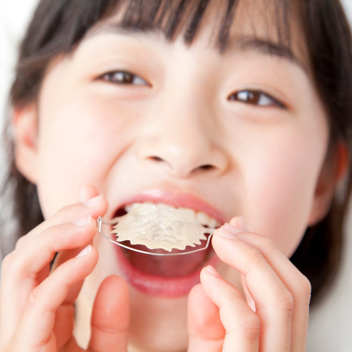 子どもの矯正治療