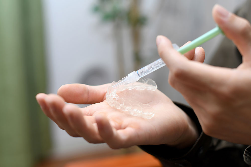 自宅でおこなうホームホワイトニング