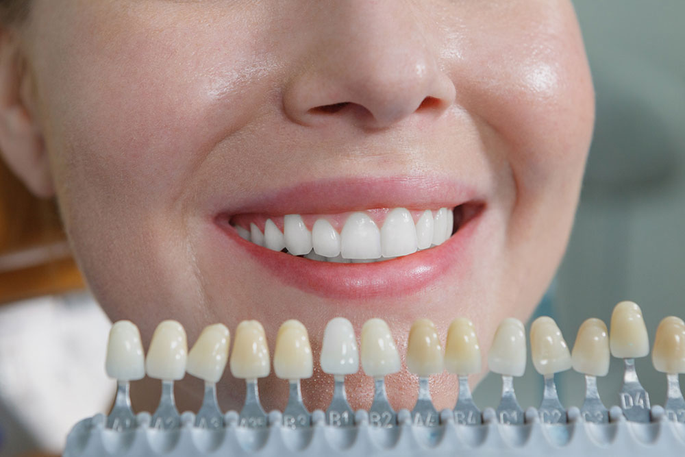 デュアルホワイトニング